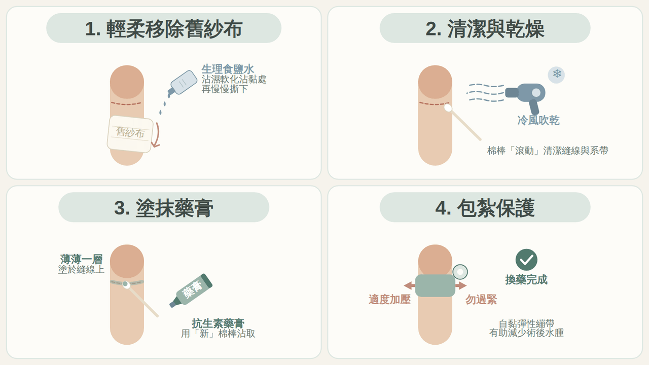 兒童雷射包皮術後縫線傷口清潔四步驟連環圖解：移除紗布、滾動式清潔縫線、塗抹藥膏、包紮保護