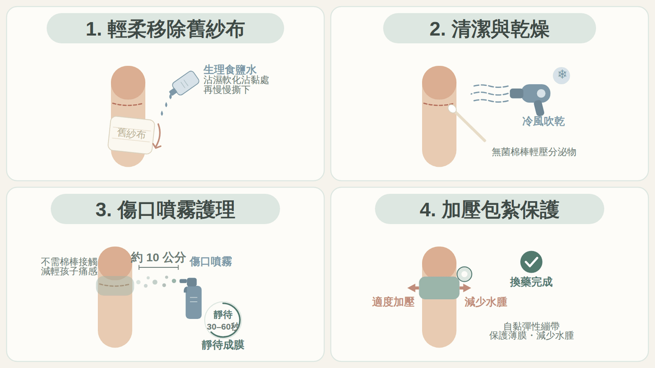 兒童包皮槍術後傷口噴霧換藥四步驟連環圖解：移除紗布、清潔乾燥、噴灑噴霧、加壓包紮